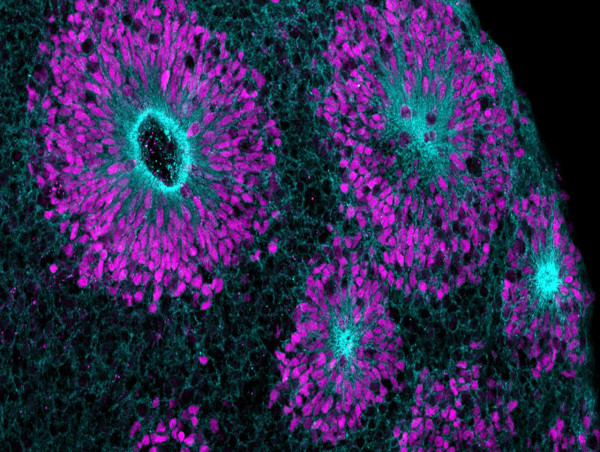  'Mini organs in a dish' to turbocharge drug discoveries 
