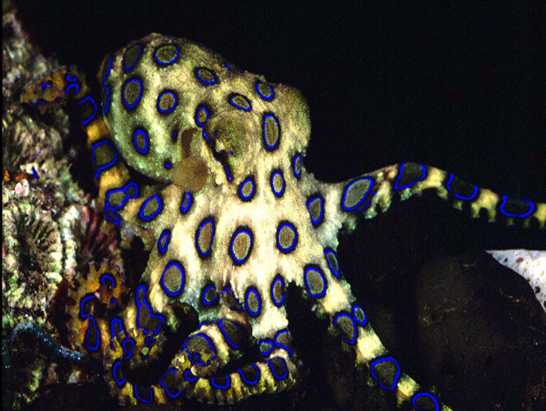  Woman bitten on stomach by blue-ringed octopus 