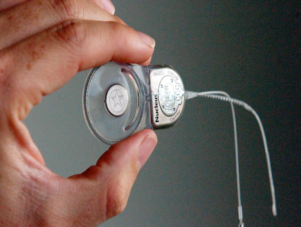  Review ordered into cochlear implant issues for SA kids 
