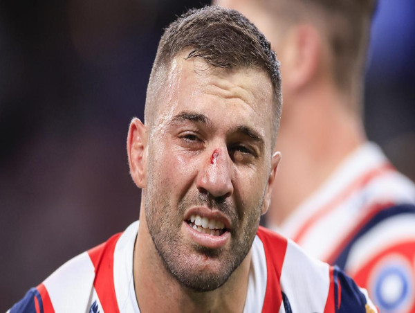 Robinson wants clarity on punishments for high shots