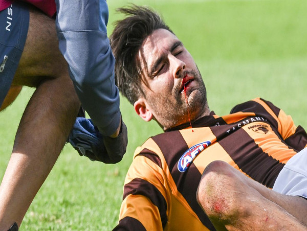  Hawks' Wingard needs surgery for lacerated tongue 
