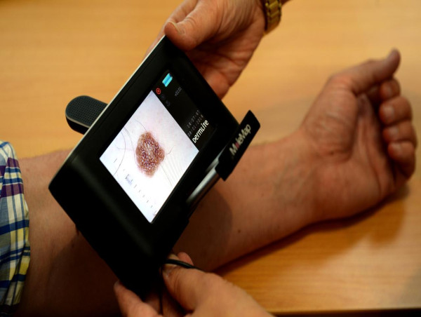  Skin cancer could lurk in 'normal-looking' skin 
