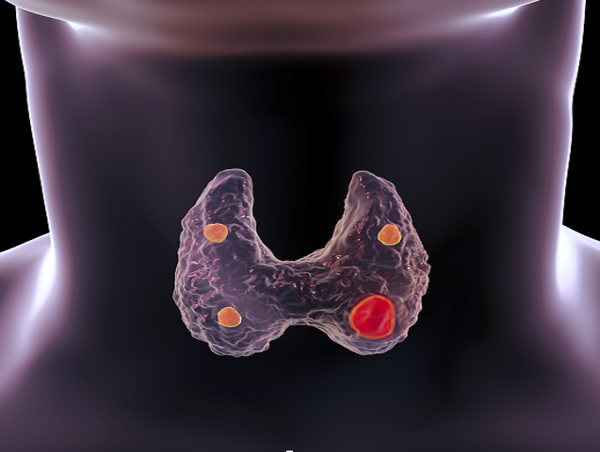  Hyperparathyroidism Market Research Report 2023-2033 | Industry Size and Growth Analysis 