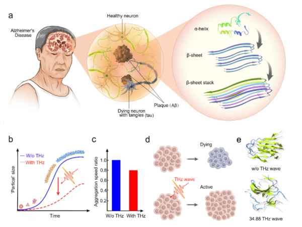 Potential Alzheimer's treatment would use high-frequency terahertz radiation