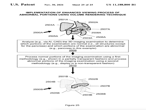  A 20th Major Improvement to the Integrated Visual Augmentation System 