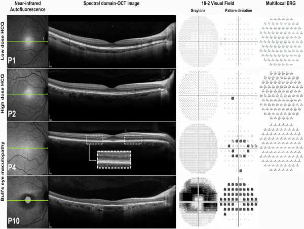 Dr. Amaro-Quireza of Columbia University Medical Center and Bronx Lebanon Hospital Center joins Retina Group of NY