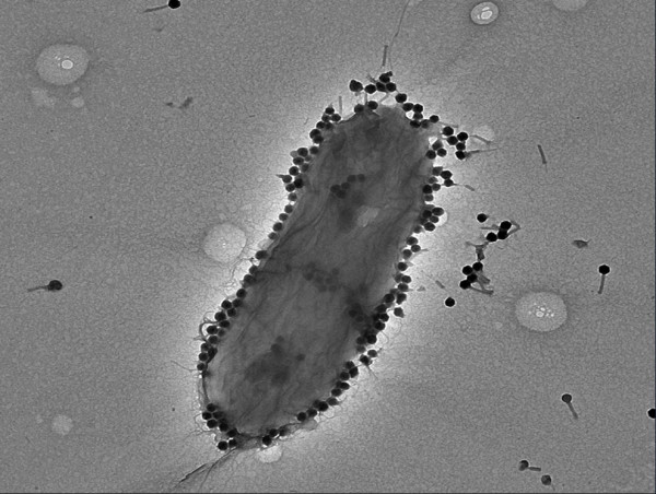 Anti-Bacterial Virus (Phage PASA16) Treated Antibiotic Resistant Infections: 86.6% Success Rate 