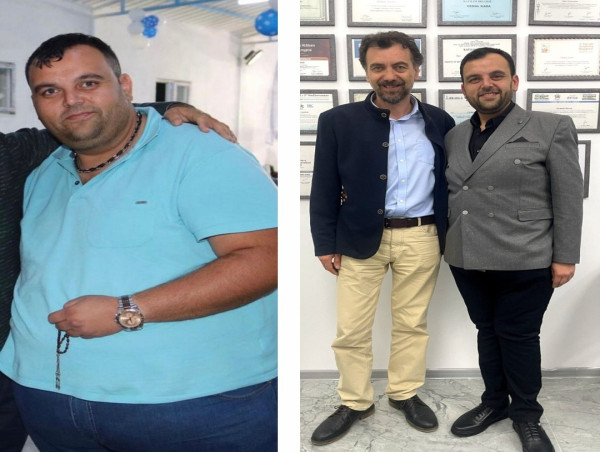  Prof. Dr. Cemal Kara talked about the successes of obesity surgery 