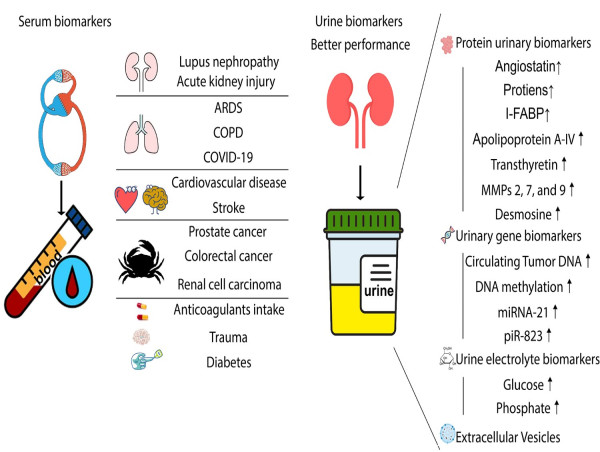  Urine biomarkers can outperform serum biomarkers in certain diseases 