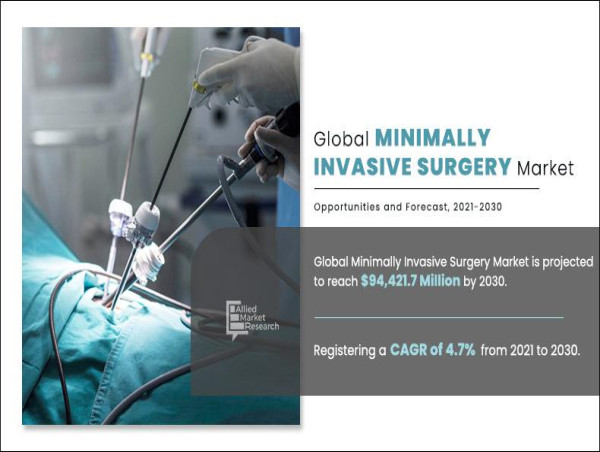  Minimally Invasive Surgery Market Sees Exponential Growth in Healthcare Sector | To Reach $94,421.7 Million 
