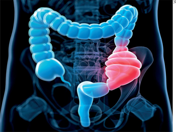  Chronic Idiopathic Constipation Market Size, Trends, Industry Statistics and Latest Insights Till 2033 