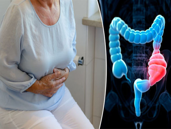Chronic Constipation Market is Projected to Grow at a CAGR of 4.83% from 2023-2033
