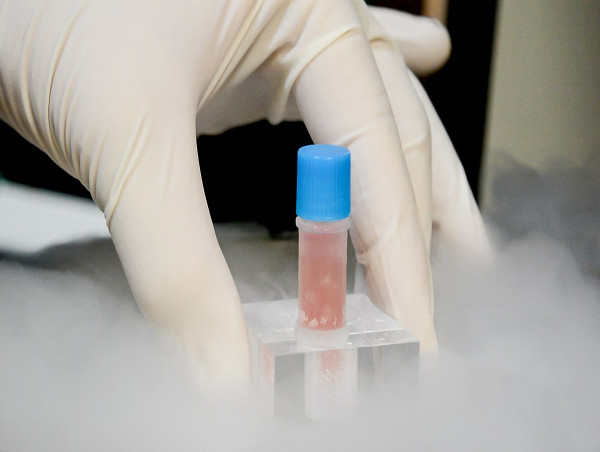  Preserving the Future: Cell Cryopreservation Market Surges with Advances in Biotechnology and Research Applications 