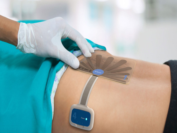 Advanced Wound Care Management Market Report 2023: Includes Latest Key Development and Market Dynamics by 2030