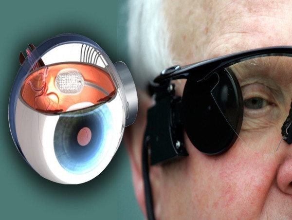  Artificial Retina Market Worldwide: Latest Industry Trades, Demand, Future prospects by 2030 |Nano-Retina, Second Sights 