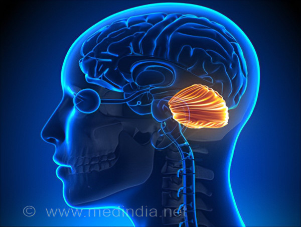  Projected Growth of 7.6% CAGR in the Spinocerebellar Ataxia Market from 2024 to 2034 | IMARC Group 