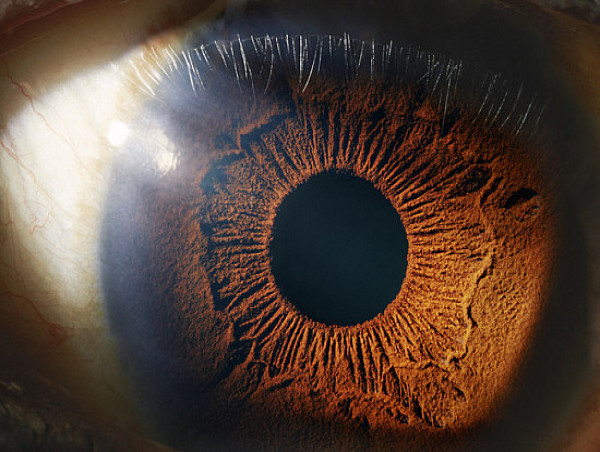  Ocular Hypertension Market Size Expected to Reach US$ 4,446.4 Million by 2033 | IMARC Group 