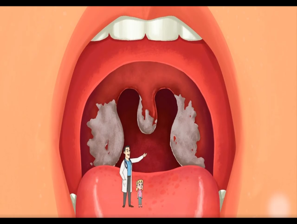  Diphtheria Market Report 2024-2034 | Industry Size, Growth and Latest Insights 