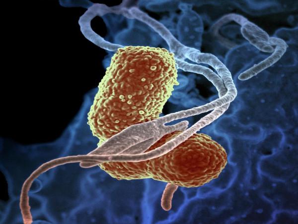 Klebsiella Pneumoniae Infections Market Report 2023-2033 | Industry Size, Growth and Latest Insights
