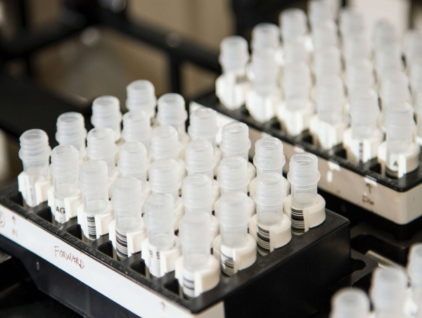 TG Therapeutics stock popped 11% on Wednesday: here’s why