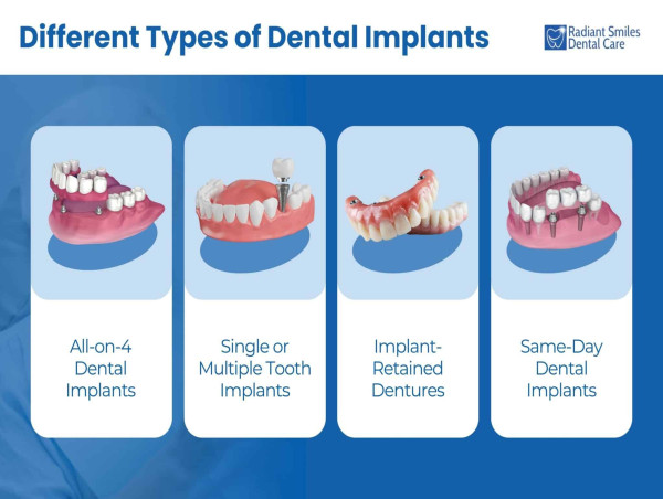 Radiant Smiles Unveils Dental Implants Treatment for Patients in Albany, WA