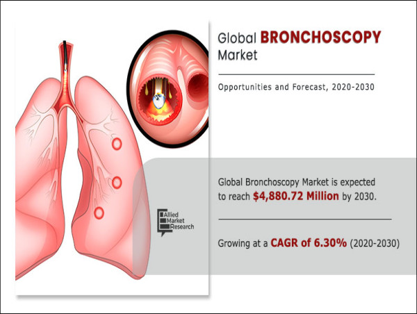 Bronchoscopy Market Size valued reach $4,880.72 million by 2030 | CAGR of 6.30% forecast 2021 to 2030.