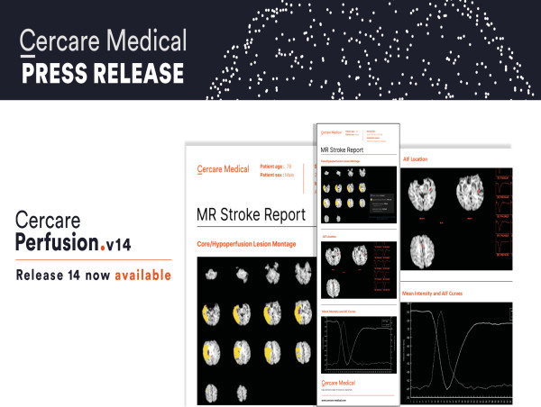 Cercare Medical Updates Neurosuite for Enhanced Stroke Diagnosis and Management