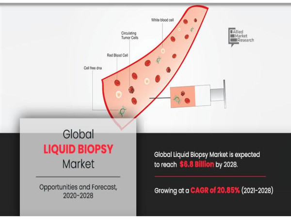  Liquid Biopsy Market Dynamics: Revolutionizing Molecular Diagnostics | CAGR 20.9% 