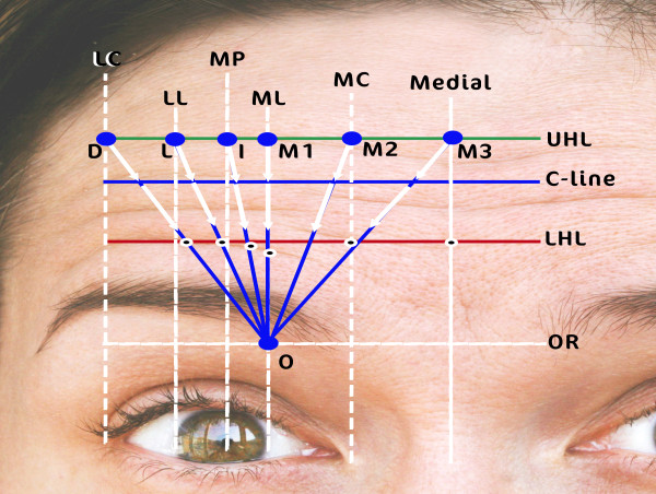  Revolutionizing Aesthetics: Dr. Alhallak's New Technique in Cosmetic Treatment 