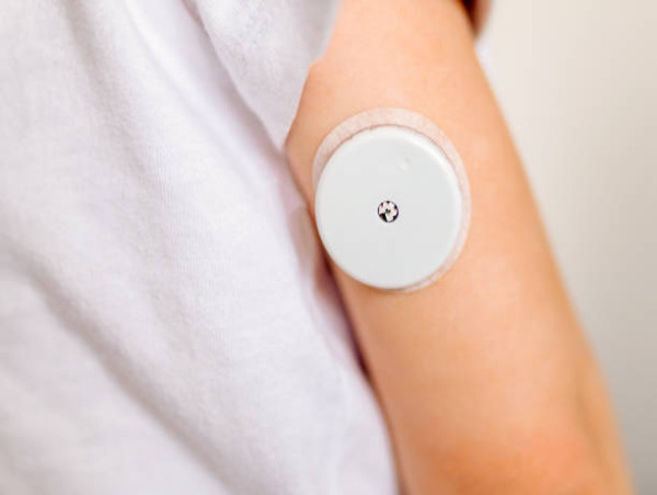  Latin America Continuous Glucose Monitoring Device Market to See Booming Growth 2024-2031 | Medtronic Plc., Abbott 