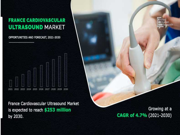 Cardiovascular Ultrasound Market in France Surges Achieving $252.90 Million by 2030, Driven by a 4.7% CAGR from 2021
