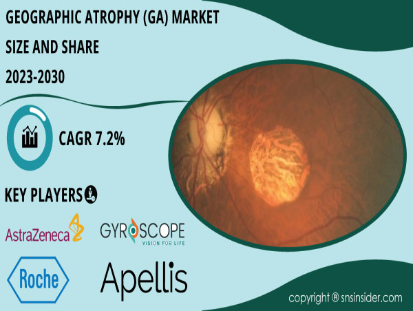  Geographic Atrophy (GA) Market Trends, Size, Share, Growth, Companies, Forecast 2030 