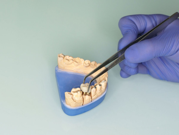 The €14.2 Billion European Dental Prosthetics Market Including CAD/CAM is fueled by Demographic and Digitization Shifts