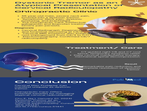  Rare Presentation of Common Disorders: Chiropractic Approach in Cervical Radiculopathy Treatment 
