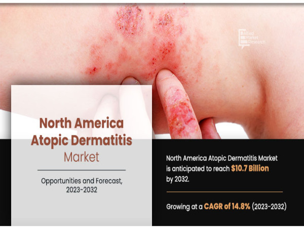 Investments in Research and Development Drive Advancements in North America's Atopic Dermatitis Market | CAGR of 14.8%
