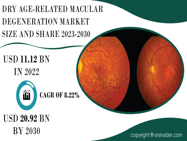 Dry Age-Related Macular Degeneration Market to Hit USD 20.92 Billion by 2030