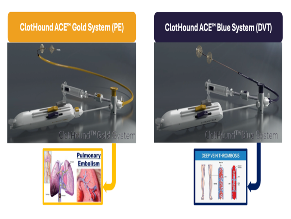 Retriever Medical Receives Australian Patent for ClotHound ACE™ Thrombectomy Systems, boosting IP portfolio globally