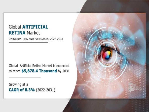  Vision of the Future: Artificial Retina Market Set to Surge to Nearly $5.9 Million by 2031 | CAGR of 8.3% 