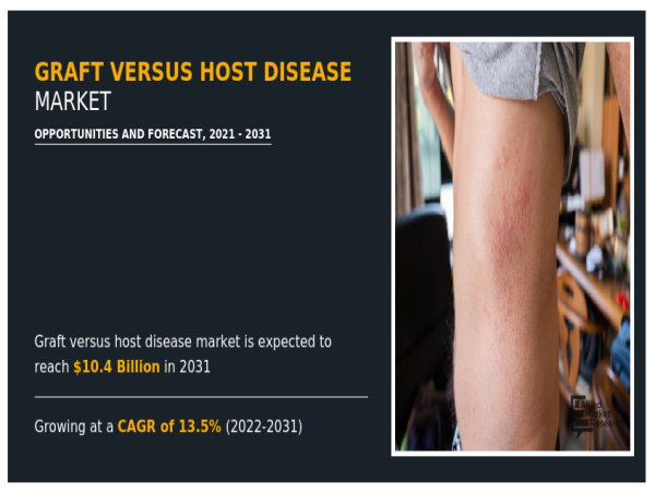 $10.4+ Bn Graft Versus Host Disease Market | at 13.5% CAGR: Globally, by 2031