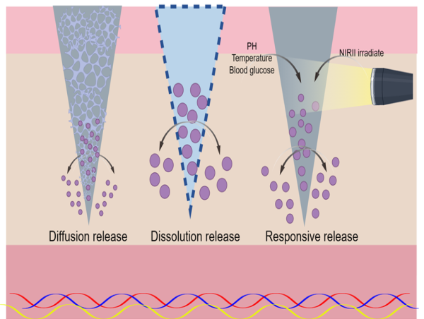  Promoting diabetic wounds healing using microneedles 