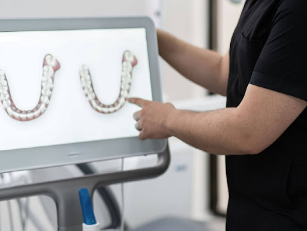 FirstClass Aligners Introduces Advanced Intraoral Scans for Local Patients