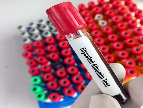  Glycated Albumin Assay Market Growth in Future Scope 2024-2031 | Asahi Kasei Pharma Corporation, Weldon Biotech Inc. 