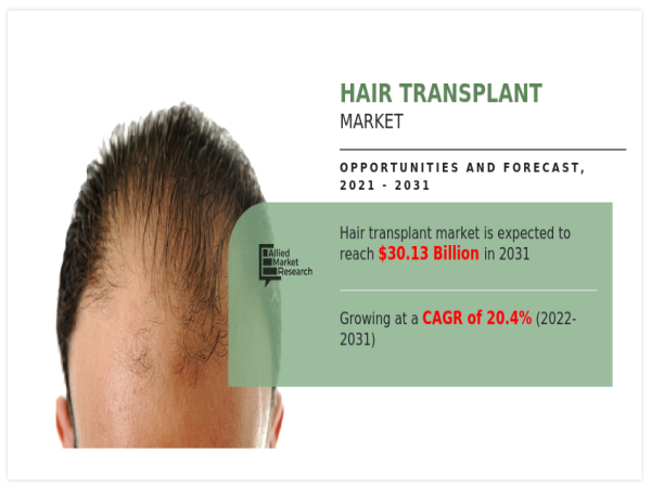  Global Hair Transplant Market Projected to Reach $30.13 Bn by 2031, Driven by Rising Demand & Technological Advancements 