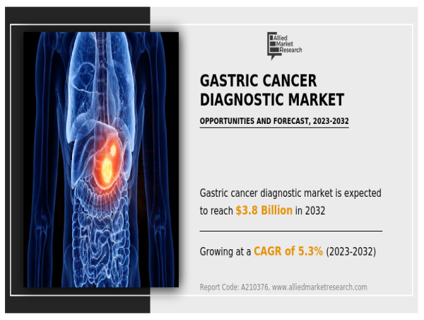 Gastric Cancer Diagnostics Market Dynamics, Growth Factors, and Industry Analysis by 2023-2032