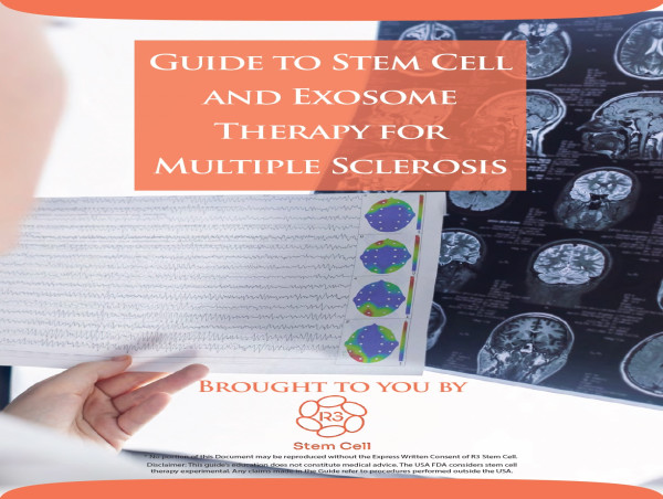 R3 Stem Cell International Publishes Guide on Stem Cell Therapy for Multiple Sclerosis