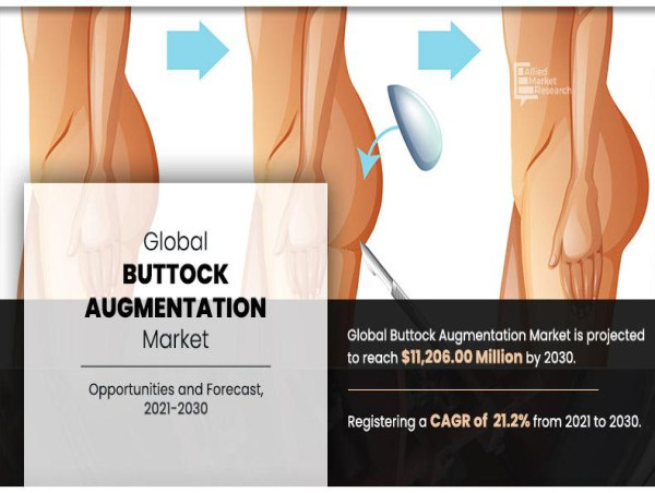 Buttock Augmentation Market Updates 2024 : is Predicted to Surpass USD 11.2 Billion by 2030
