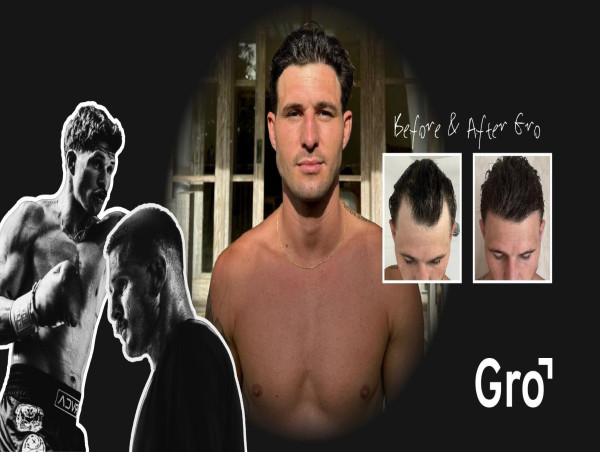  Gro Clinics Now Offers Complimentary Consultations to Help Clients Start Their Hair Restoration Journey 