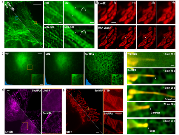 Improving resolution and reducing noise in fluorescence microscopy with ensured fidelity