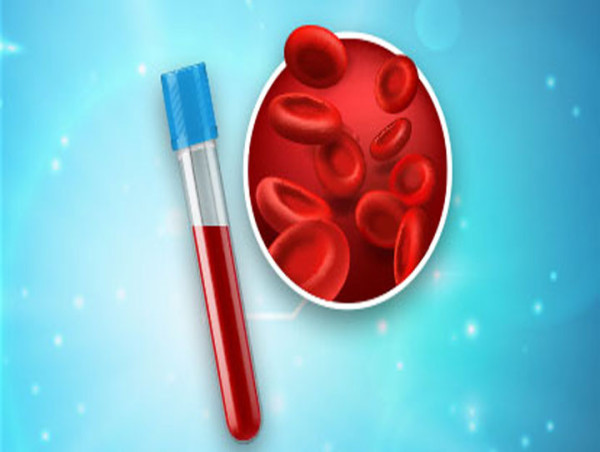 Bloodstream Infection Testing Market Projected To Witness Substantial Growth, 2024-2031: Abbot Laboratories, Cepheid Inc 