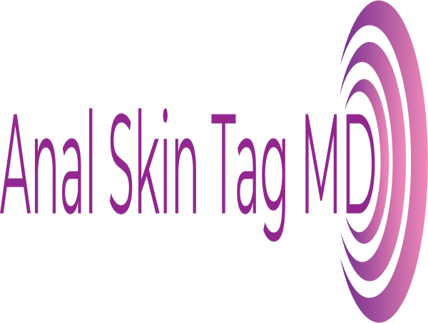  Anal Skin Tag MD Unveils Revolutionary Non-Surgical Procedure for Anal Skin Tag Removal 